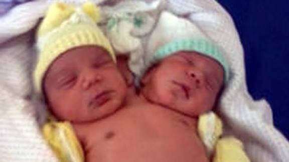BABY SENSATION IN DERBY! STAR PLAYER WELCOMES JOINT TWINS – A HEART-TOUCHING MIRACLE STORY